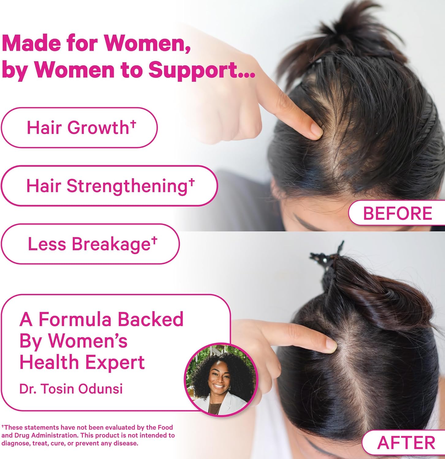 Pink Stork Postpartum Hair Loss Gummies - görsel 3