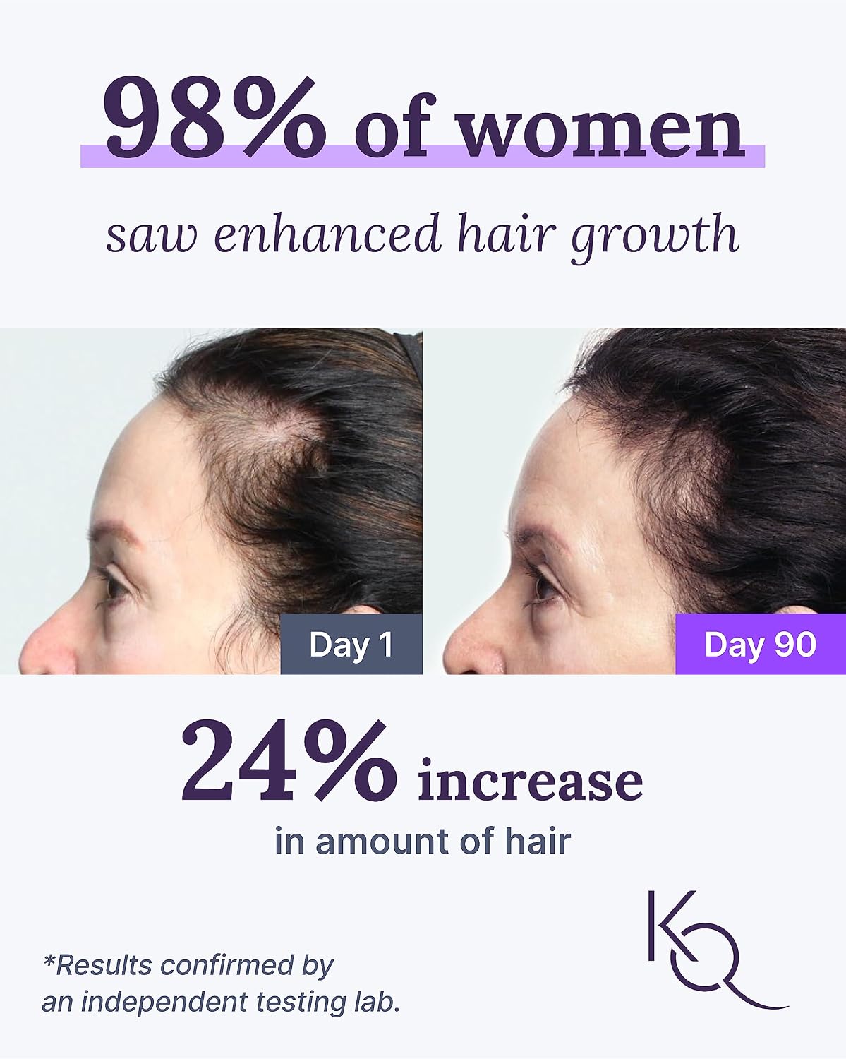Keranique Hair & Scalp Supplements - Supports Strength and Vitality with Biotin and Keraviatin - görsel 2