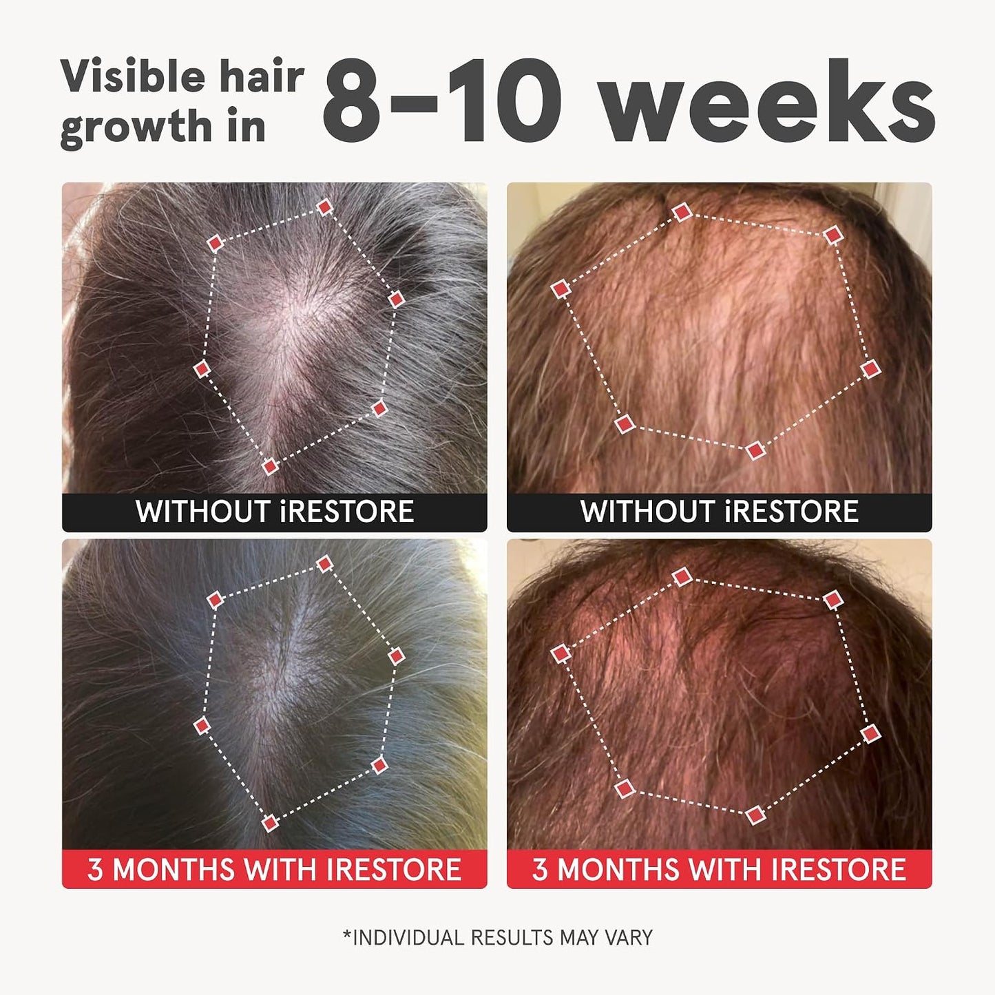 iRestore Advanced Hair Growth Supplement for Women with Lustriva - görsel 2