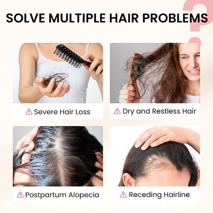 NiceTop Hair Growth Supplement for Women with Biotin & Saw Palmetto