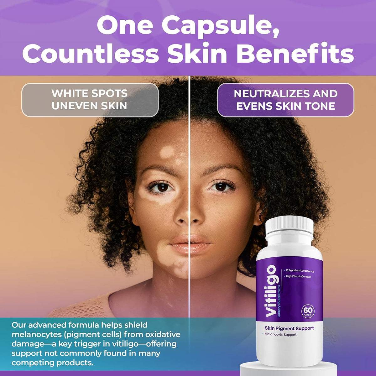 AURA VITAMINS Vitiligo Capsules (60 Capsules) - görsel 6