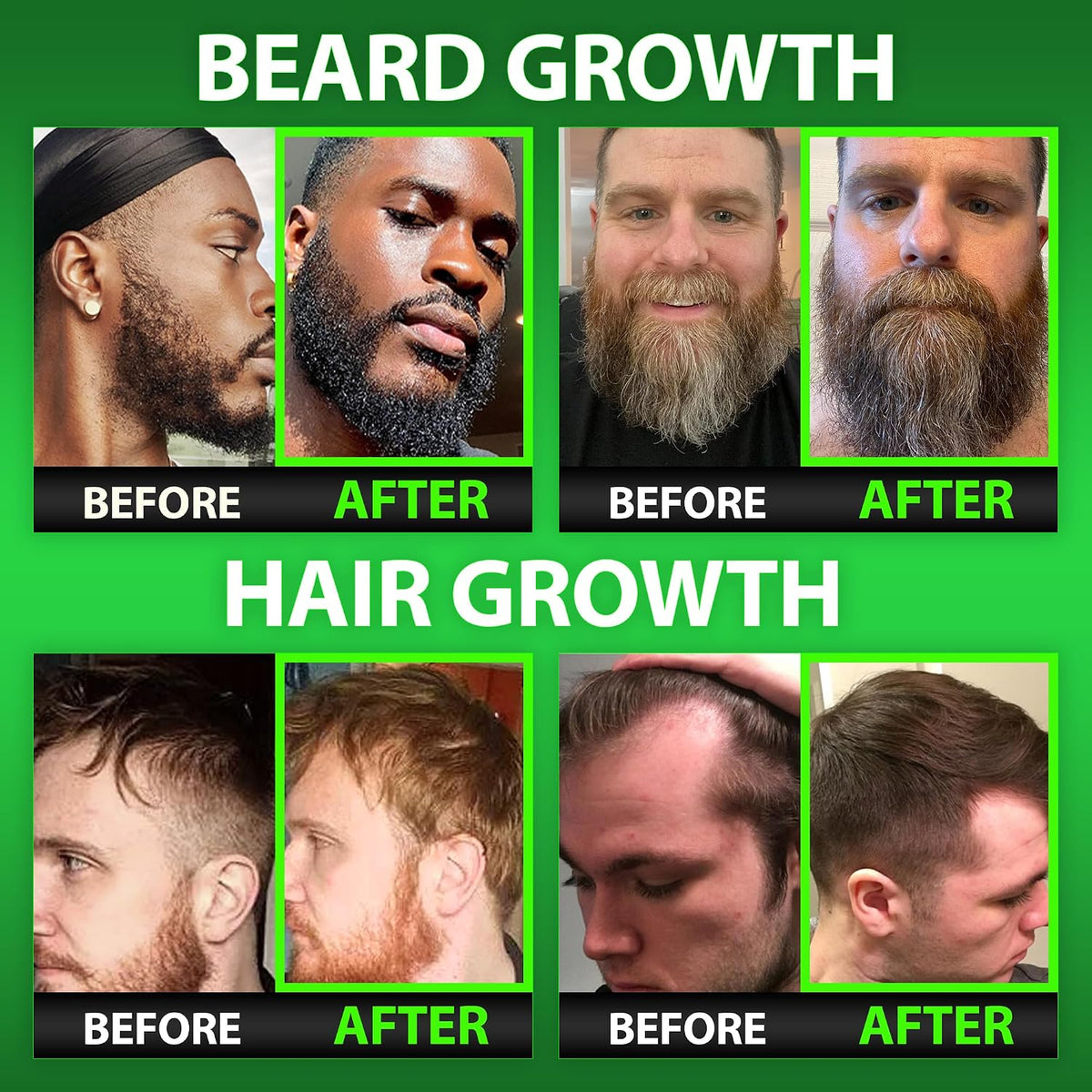 Best Beard Stuff Beard Growth Vitamins: Biotin Gummies for Beard & Hair Growth – Maximum Strength with Collagen, MSM, Keratin & Bamboo Extract - görsel 2
