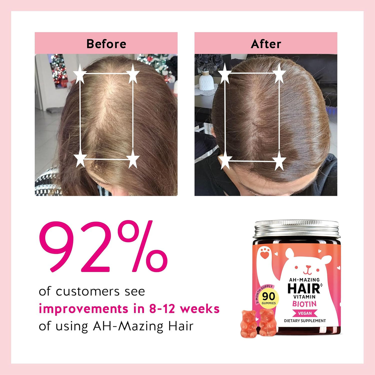 Biotin Gummies for Hair, Skin and Nails. 5,000 mcg High Potency Vegan Vitamins for Normal Hair and Nails and Healthy Skin. with Vitamins C and E, 90 Gummies - görsel 4