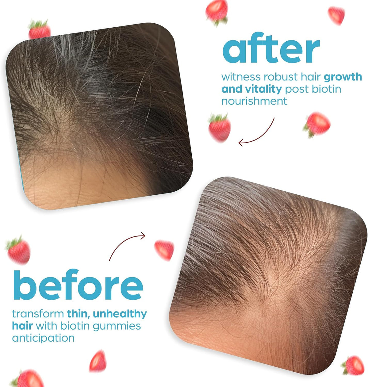 Artnaturals Biotin Gummies – 10,000mcg for Hair, Skin & Nails – Natural Strawberry – 100 Gummies - görsel 5