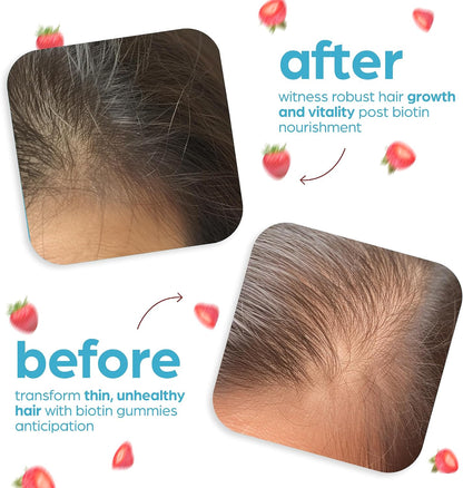 Artnaturals Biotin Gummies – 10,000mcg for Hair, Skin & Nails – Natural Strawberry – 100 Gummies