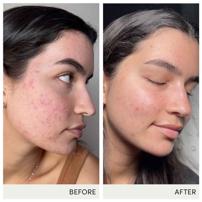 jane iredale Skin Accumax Nutritional Supplement - 90 Day Supply