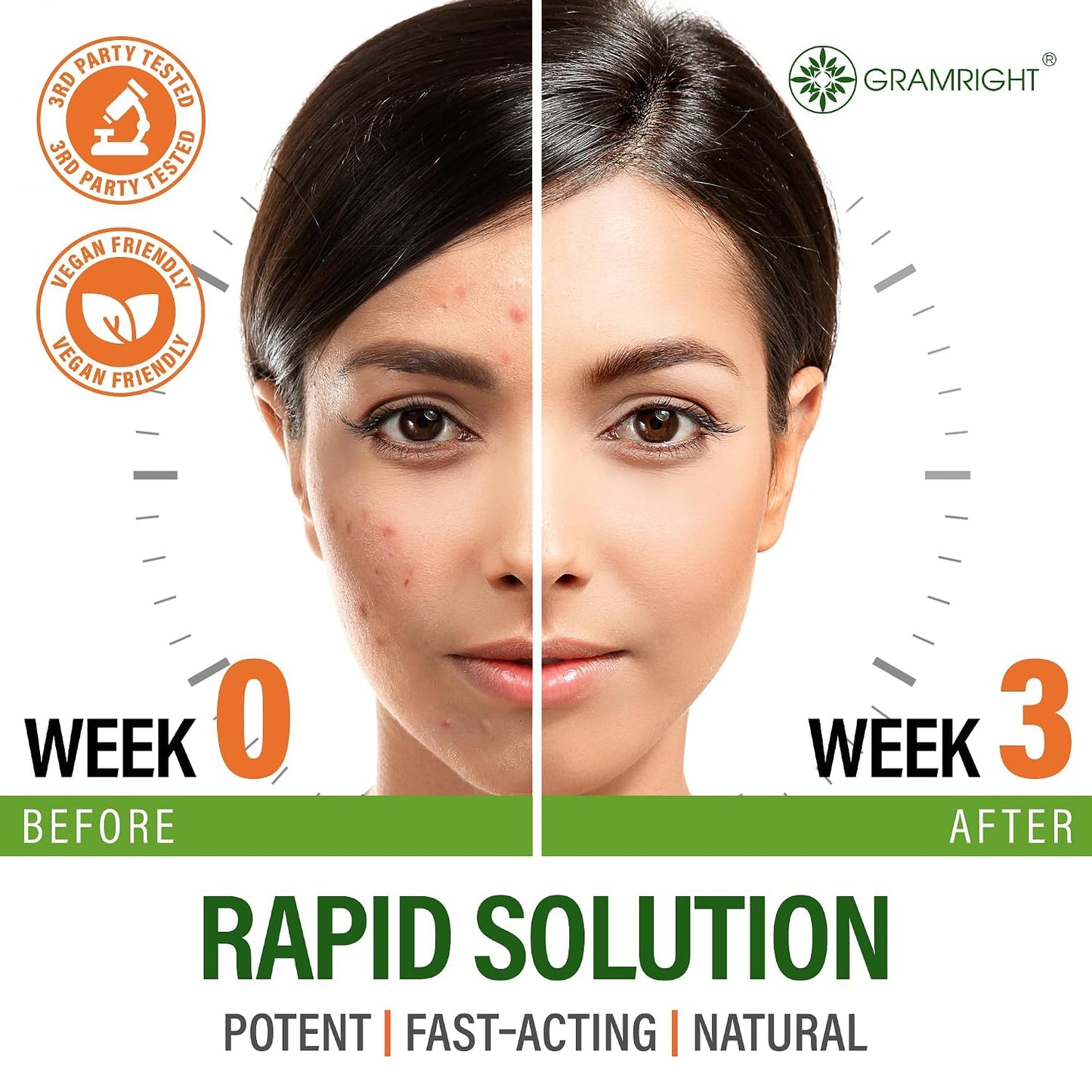 Perfect Skin Acne Capsules - Skin Support with Niacinamide, Probiotic, Zinc & Vitamin A (60 Capsules) - görsel 3