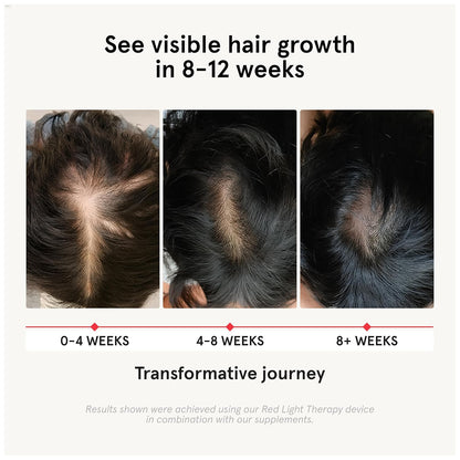 iRestore Hair Growth Supplement - Biotin & Multivitamins for Hair Support for Women and Men, 90 Capsules (30-Day Supply)