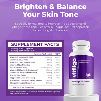 AURA VITAMINS Vitiligo Capsules (60 Capsules)