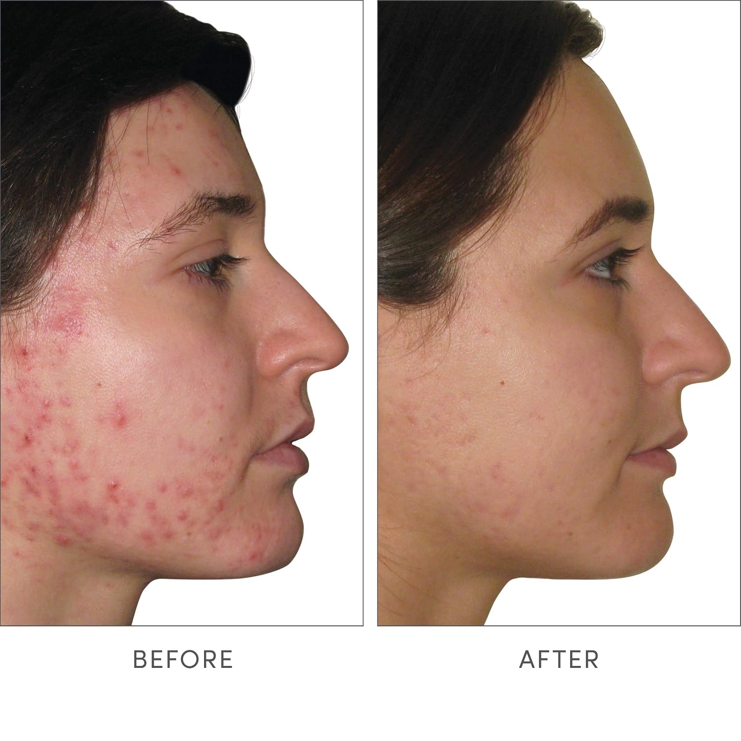 jane iredale Advanced Nutrition Programme Skin Accumax Supplement - görsel 3