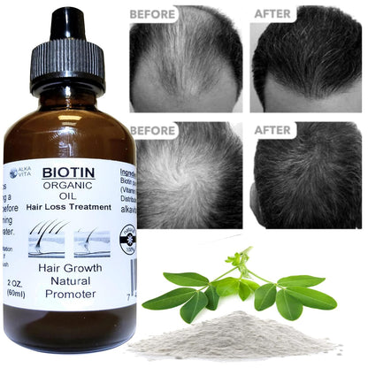 Biotin Pure Organic Oil Hair Treatment with Peanut Oil and Silica