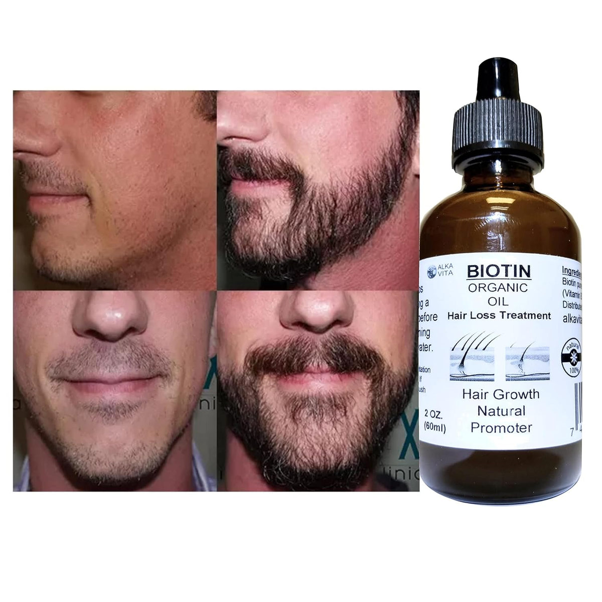 Biotin Pure Organic Oil Hair Treatment with Peanut Oil and Silica - görsel 6