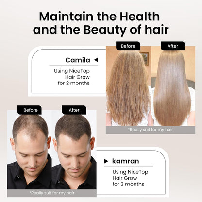 NiceTop Hair Growth Supplement for Women with Biotin & Saw Palmetto
