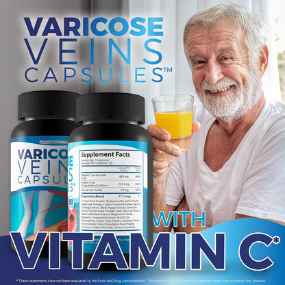 Varicose Vein Capsules – Herbal Supplement for Vein Health